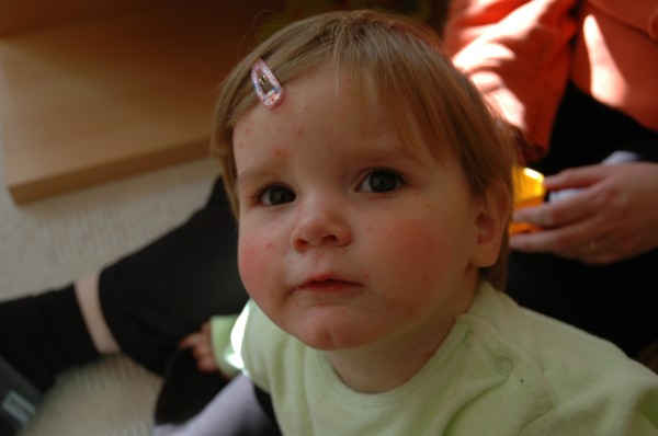 Click for the original image